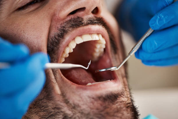 Best Dentist for Severe Toothache  in Mount Pleasant, WI
